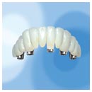 procera implant abutment