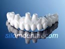Procera Implant Bridge Zirconia