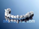 Procera Zirconia Bridge