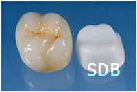 all ceramic crown