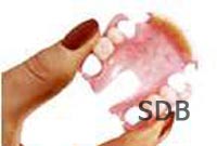 Thermoplastic Denture