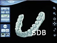 Lava chaieside oral scanner