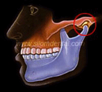 Temporomandibular Joint TMJ