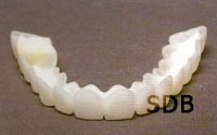 Snap-On Smile Cosmetic Removable Partial Denture