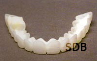 Full Denture in Dental Clinic Bangkok