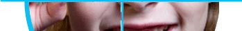 ҡѹӹпѹش stem cell