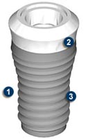 ITI Dental Implants