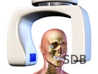 straumann ct-scan