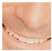 Confident smile with ITI Dental Implants