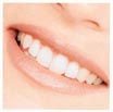 Confident smile with ITI Dental Implants