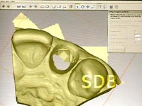 new treatment option with Roxolid implants