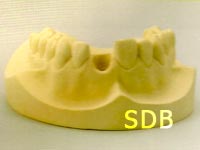 new treatment option with Roxolid implants