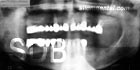before implant replacement of several teeth case at Silom Dental Building Clinic